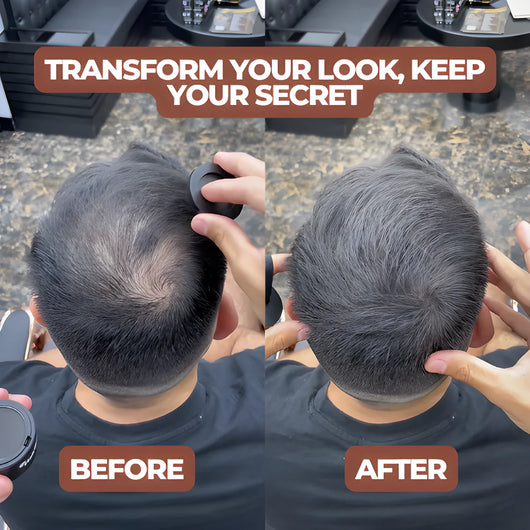 Rogain™ Hair Cover Up Powder